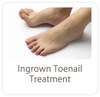 巻き爪・陥入爪治療