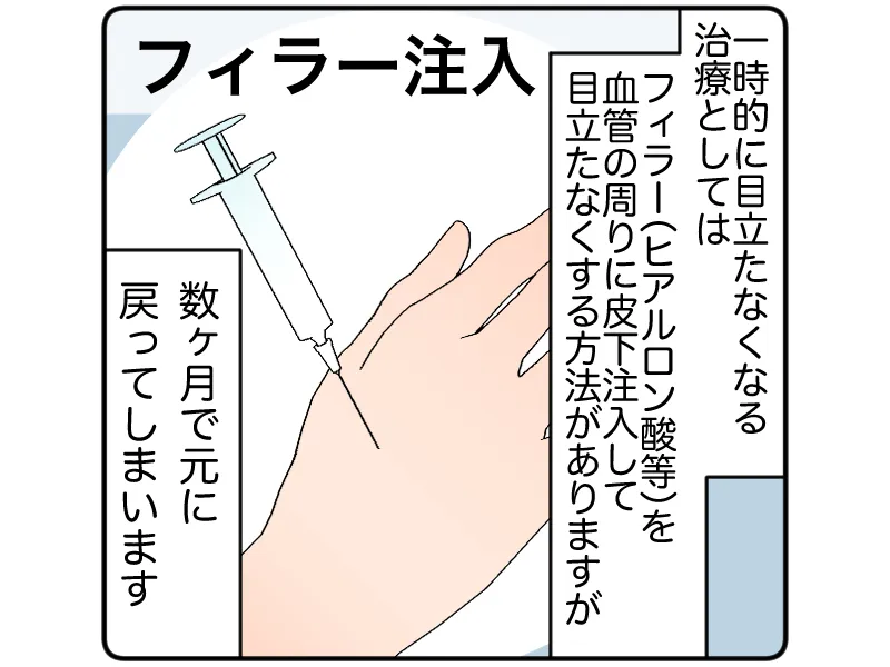 「フィラー注入:一時的に目立たなくする治療としてはフィラー(ヒアルロン酸等)を血管の周りに皮下注入して目立たなくする方法がありますが、数か月でも元に戻ってしまいます」