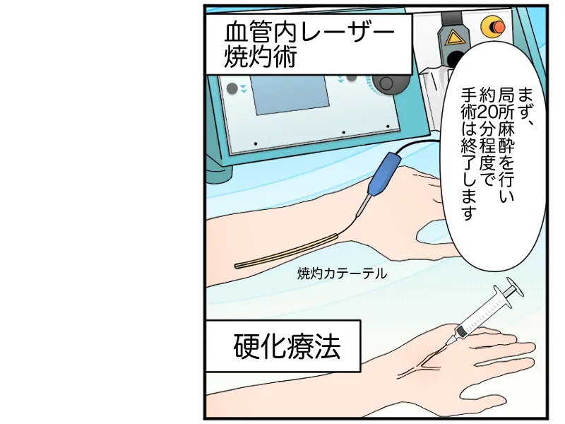 「まず、局所麻酔を行い約20分程度で手術は終了します(血管内焼灼術、硬化療法)」