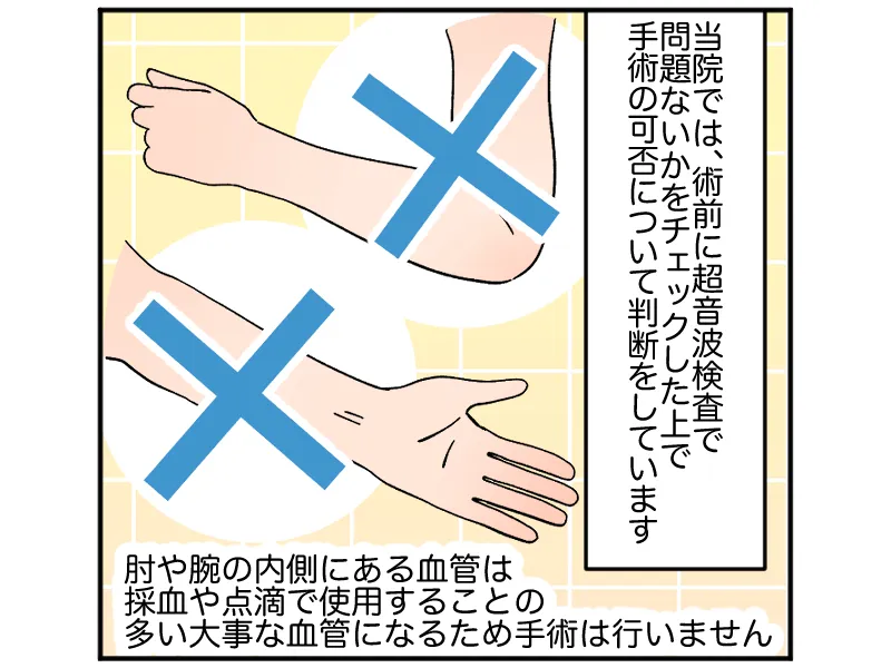 「当院では、術前に超音波検査で問題がないかをチェックした上で手術の可否について判断をしています」「肘や腕の内側にある血管は、採血や点滴で使用することの多い大事な血管になるため手術は行いません」
