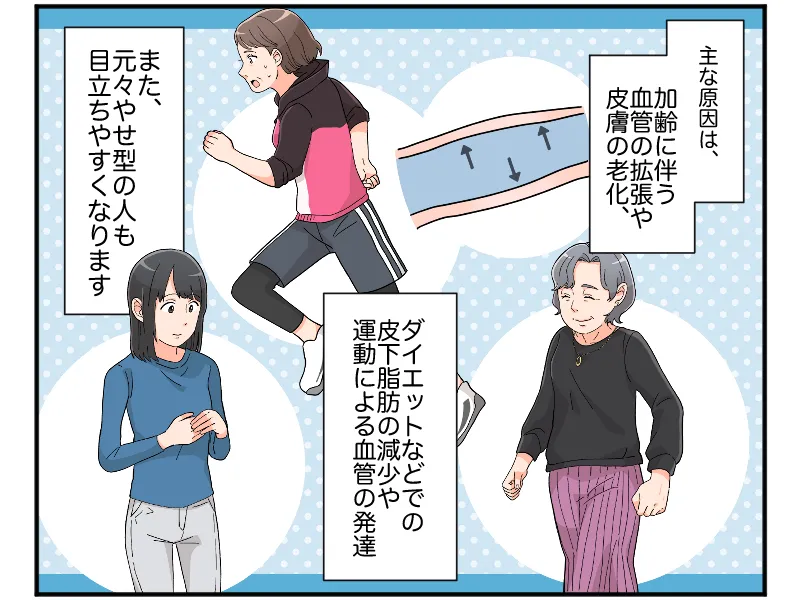 「「主な原因は、加齢に伴う血管の拡張や皮膚の老化、ダイエットなどでの皮下脂肪の減少や運動による血管の発達、また、元々やせ型の人も目立ちやすくなります」