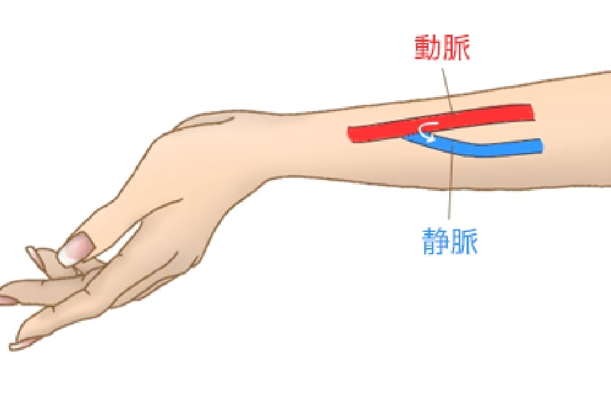 自己血管での作製の説明