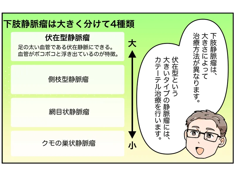 下肢静脈瘤は大きく分けて4種類。伏在型静脈瘤、側枝型静脈瘤、網目状静脈瘤、クモの巣状静脈瘤。「下肢静脈瘤は、大きさによって治療法が異なります。伏在型という大きいタイプの静脈瘤には、カテーテル治療を行います」