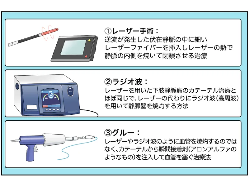 レーザー手術、ラジオ波手術、グルー手術