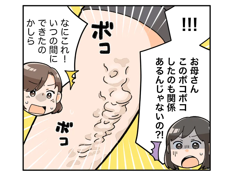 「！！お母さん、このボコボコしたのみ関係あるんじゃないの？！」「なにこれ！いつの間にできたのかしら」